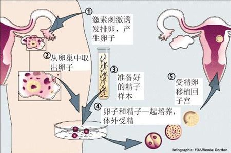 供卵包男孩正规代生公司